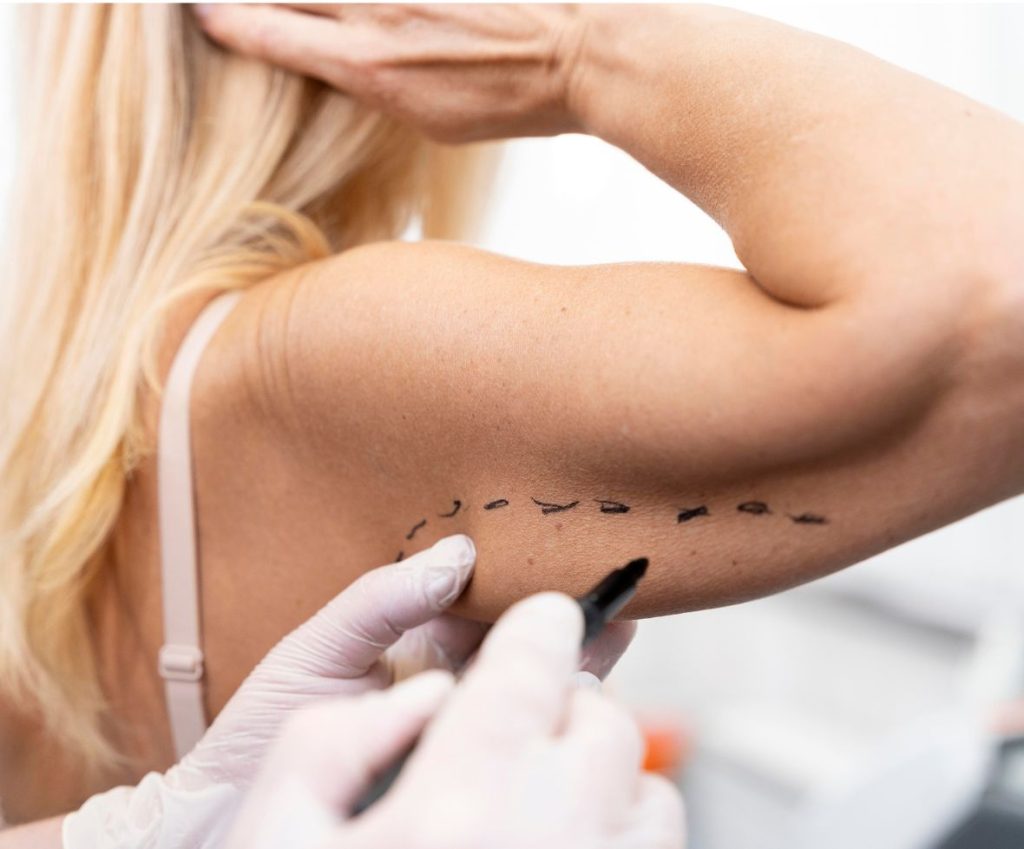 Cirurgião Plástico em Curitiba