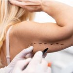 Cirurgião Plástico em Curitiba